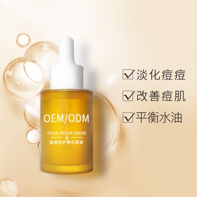 孝感市_祛痘精华原液OEM